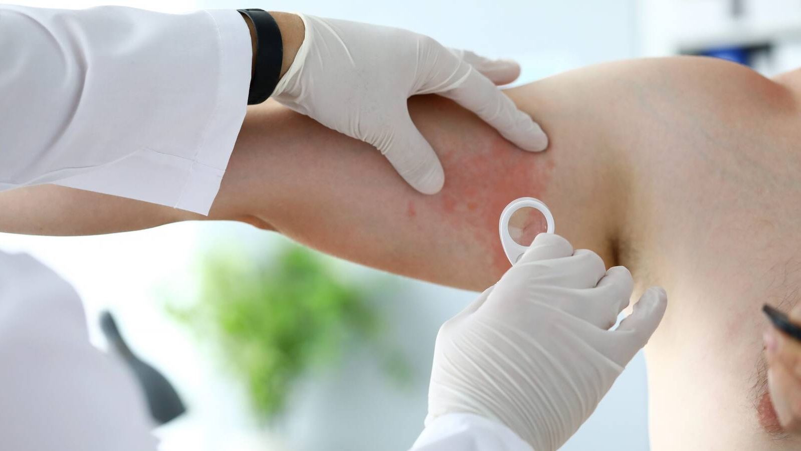 Escasez de dermatólogos en Madrid: una demanda creciente y una oferta insuficiente