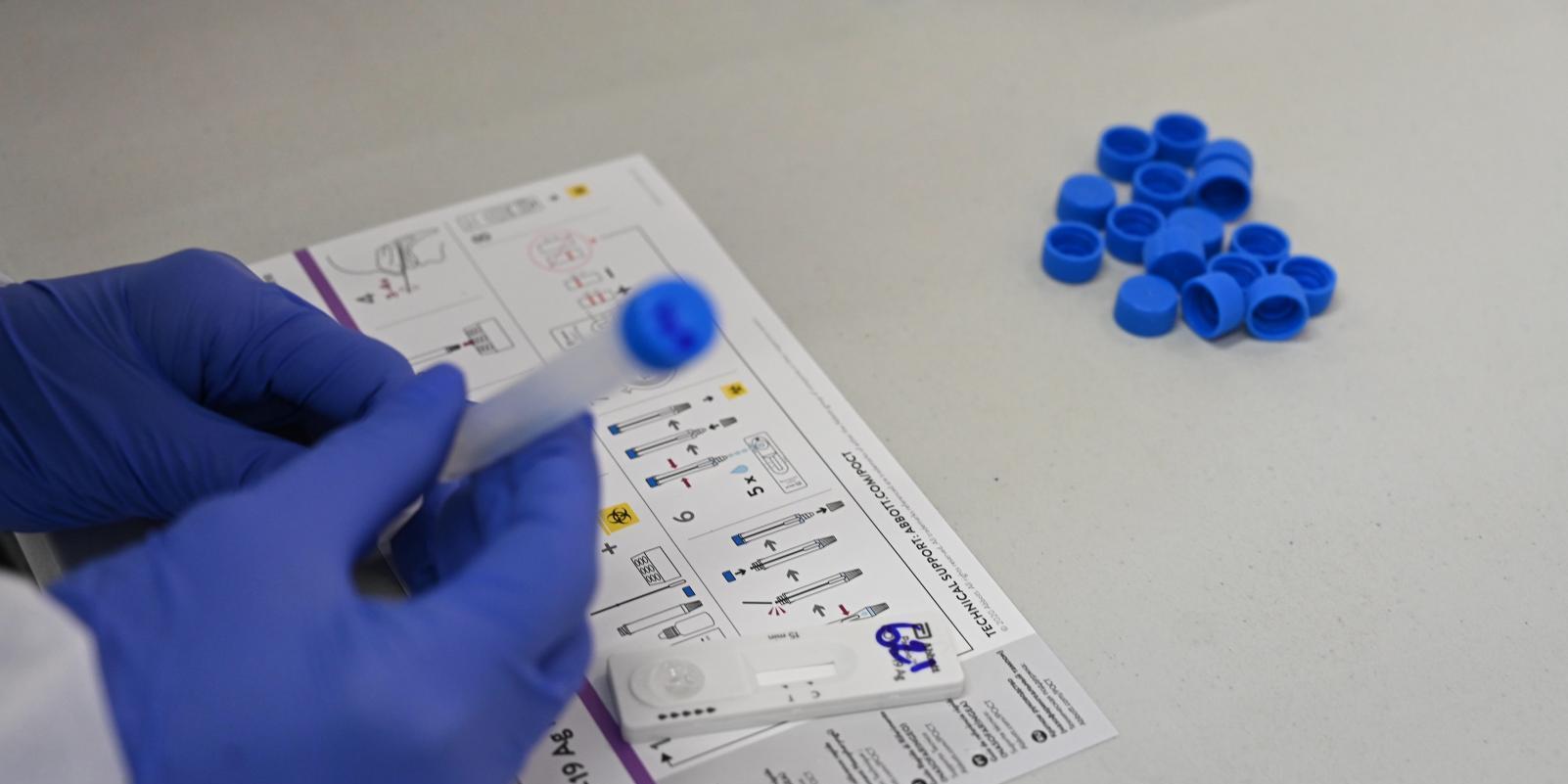 Cuatro Nuevos Dispositivos De Test De Antígenos En La Región Madrid Actual 2563